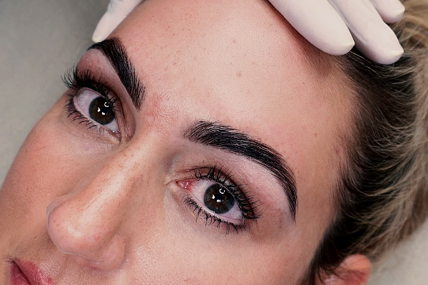 hollywood brow lift