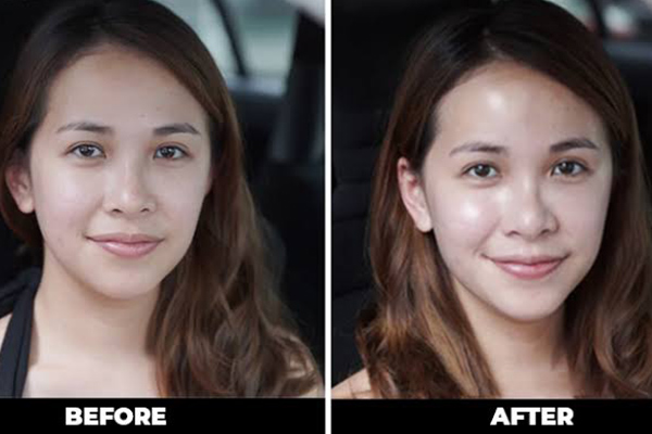 korean facial treatment