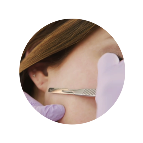dermaplaning panache and poise tvm